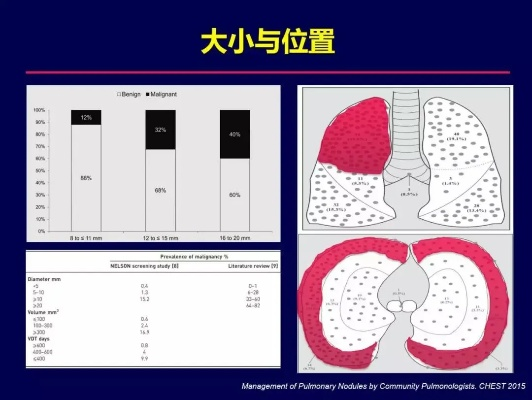 郭艾伦肺部结节大小测量及治疗方法分析-第2张图片-www.211178.com_果博福布斯